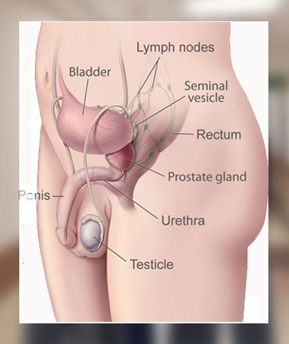 Dr. Anirudh Kaushik Best Prostate Surgeon in Delhi NCR