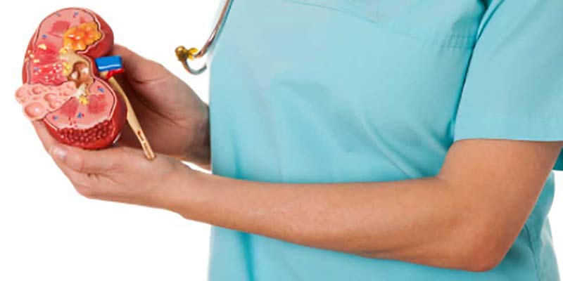 Kidney Stone Laser Treatment