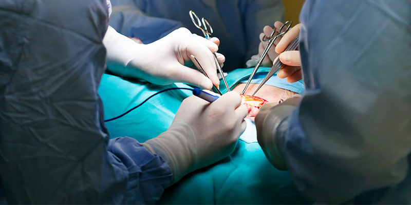 Prostate Laser Surgery